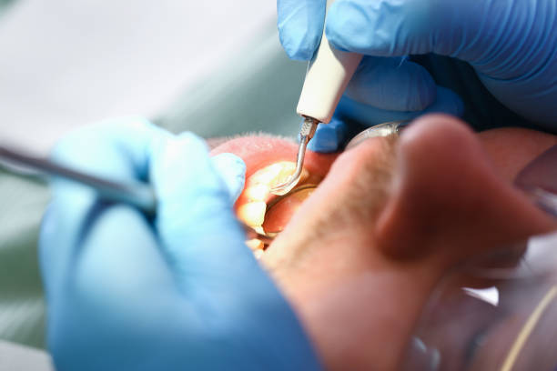 Best Cracked Tooth Emergency Dentist  in Colonial Heights, TN