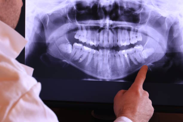 Best Tooth Infection Emergency Dentist  in Colonial Heights, TN