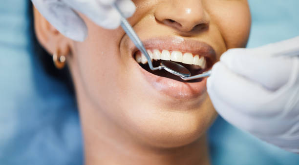 Best Chipped Tooth Repair Near Me  in Colonial Heights, TN