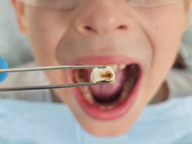 Best Emergency Gum Pain Relief  in Colonial Heights, TN