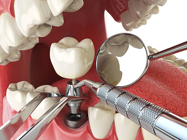 Best Tooth Infection Emergency Dentist  in Colonial Heights, TN